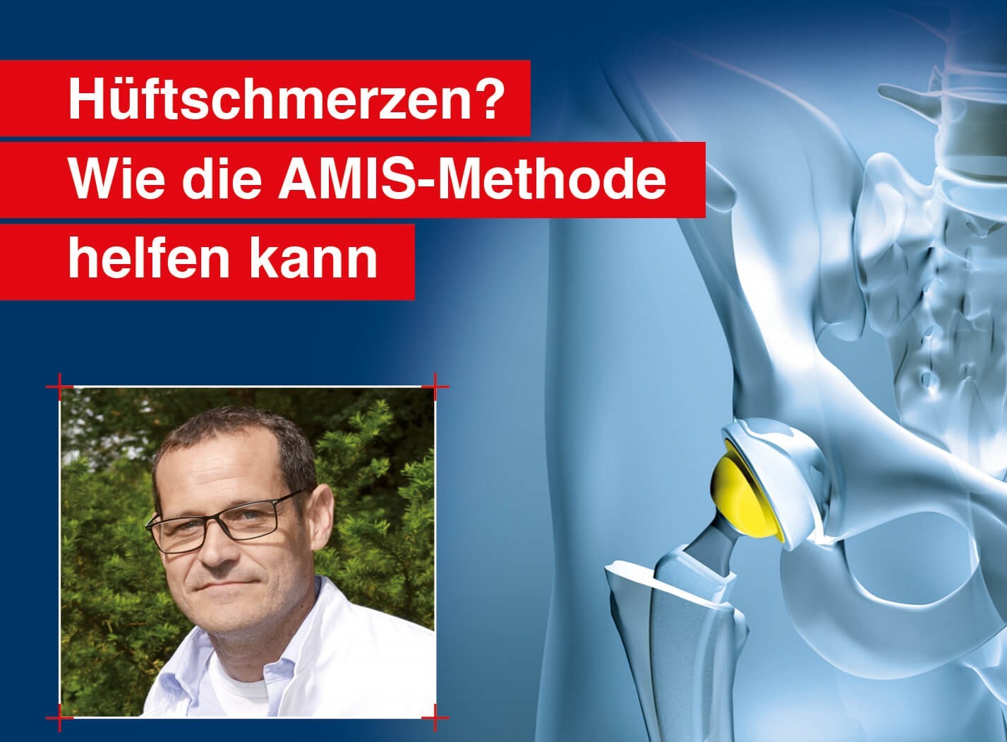 Medizinischer Infoabend: Hüft-Ersatz mit der AMIS-Methode